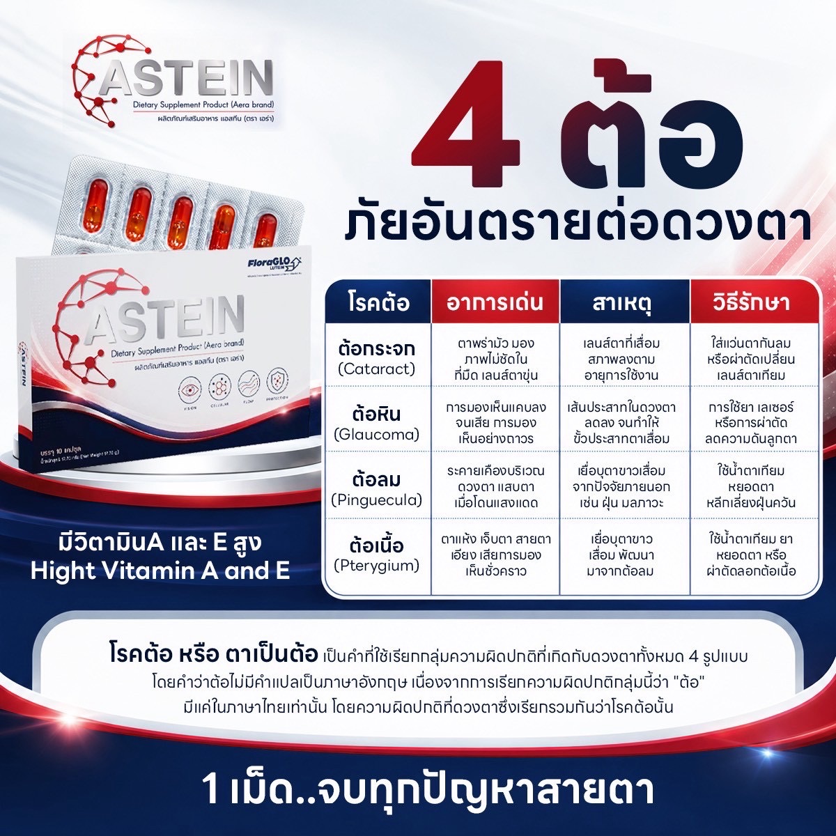 ข้อมูลปัญหาดวงตา 4 กลุ่ม ได้แก่ ต้อกระจก ต้อหิน ต้อลม และต้อเนื้อ